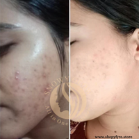 Snowy Glow Daily Use Face Cream 100ml – Hydration + Glow for All Skin Types