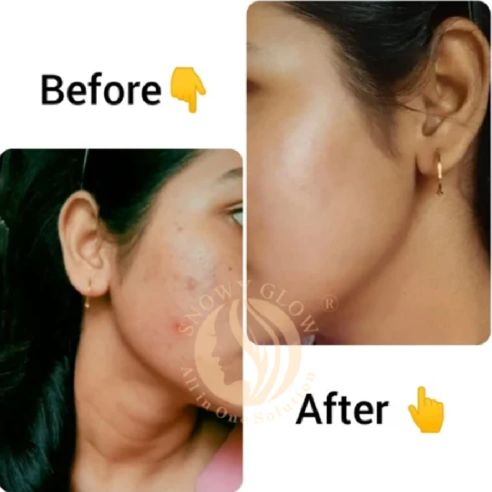 Snowy Glow Daily Use Face Cream 100ml – Hydration + Glow for All Skin Types