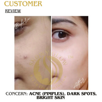 Snowy Glow Daily Use Face Cream 100ml – Hydration + Glow for All Skin Types