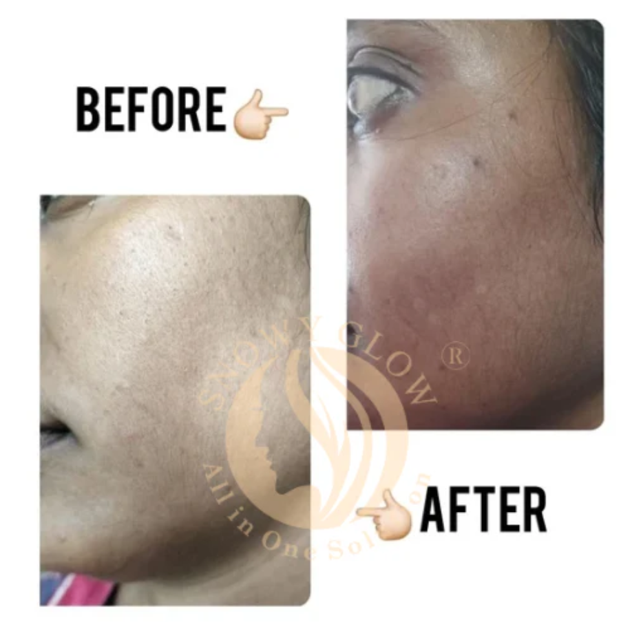 Snowy Glow Daily Use Face Cream 100ml – Hydration + Glow for All Skin Types