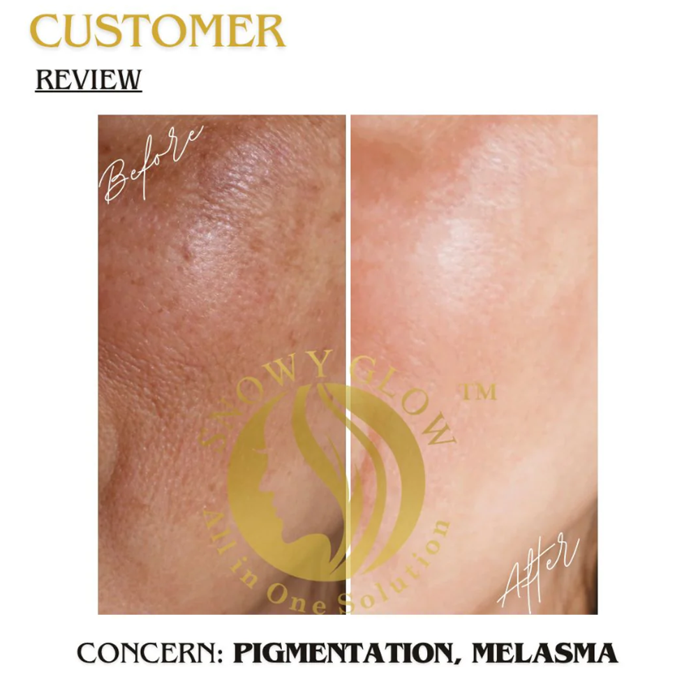 Snowy Glow Daily Use Face Cream 100ml – Hydration + Glow for All Skin Types